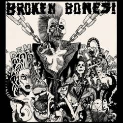 Broken Bones : Dem Bones